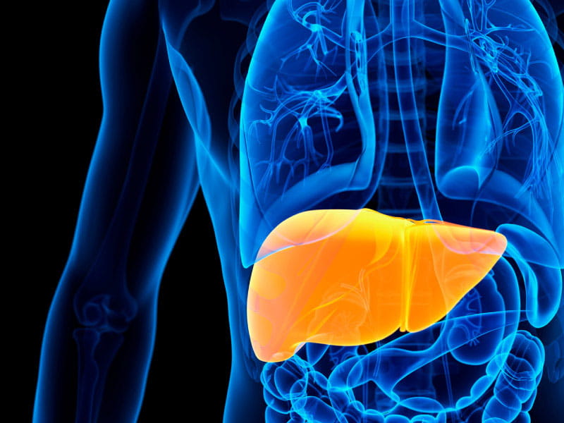 Are You At Risk Of Non-Alcoholic Fatty Liver Disease